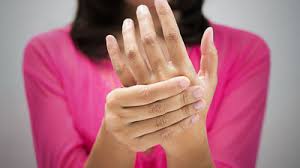 rheumatoid arthritis